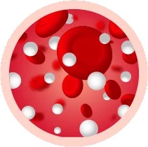Hyperglycemia