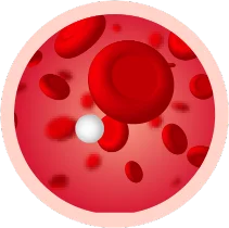Hypoglycemia