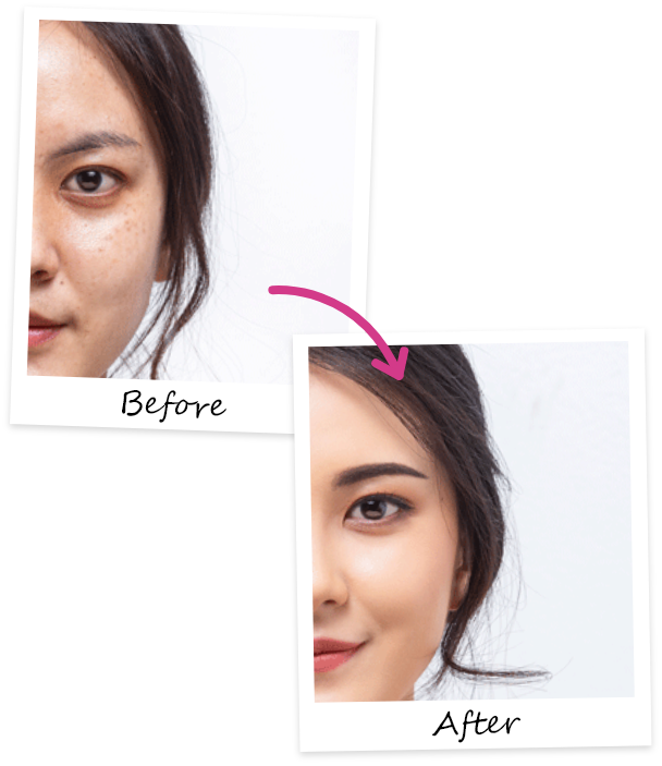 before and after